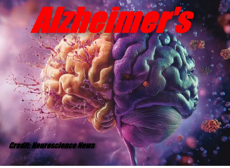 FISH NOT FISH OIL IMPROVES ALZHEIMER DEMENTIA PROFILE